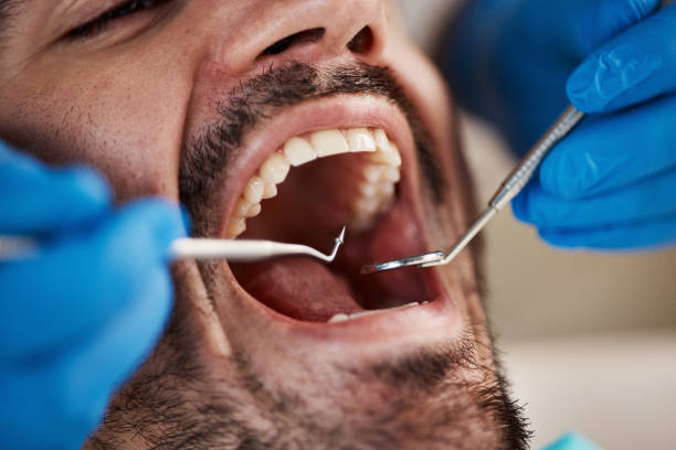 Best Emergency TMJ Treatment in Balcones Heights, TX