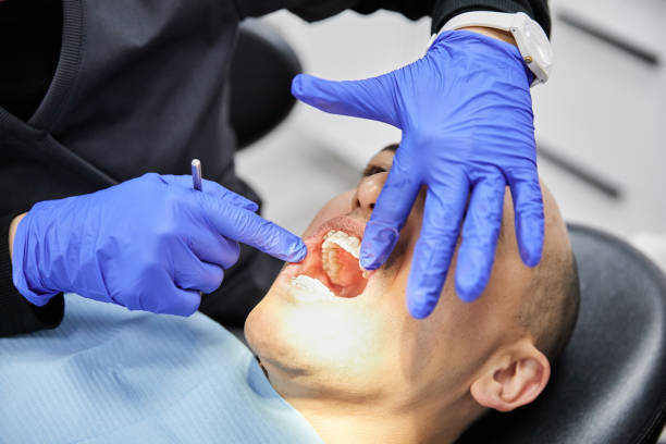 Best After-Hours Dental Trauma Care in Balcones Heights, TX